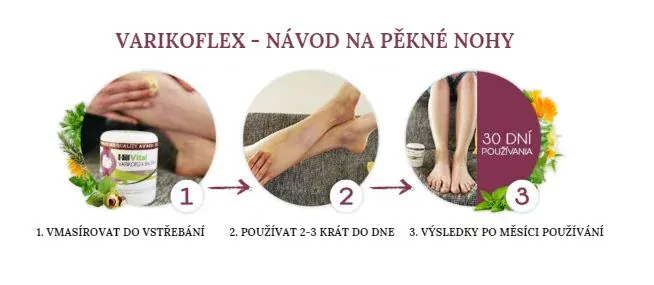 HillVital Varikoflex mast na křečové žíly 250 ml