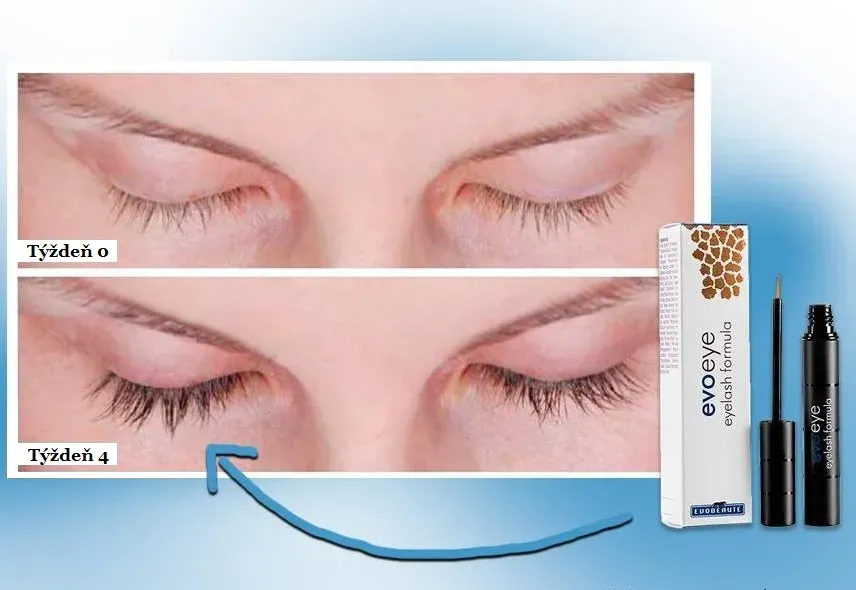 Evoeye kúra na řasy 3 ml