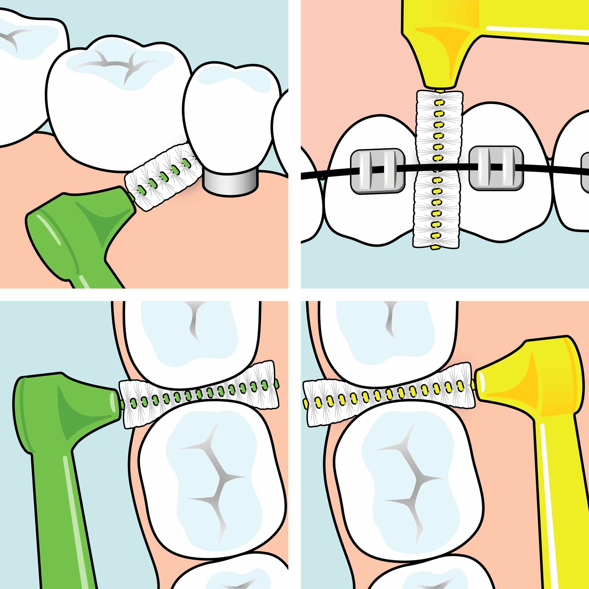 TePe Angle mezizubní kartáčky 0,4 mm 6 ks