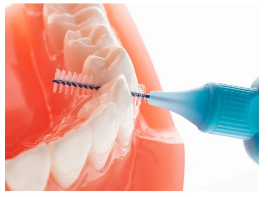 TePe Original mezizubní kartáčky 0,6 mm 25 ks sáček